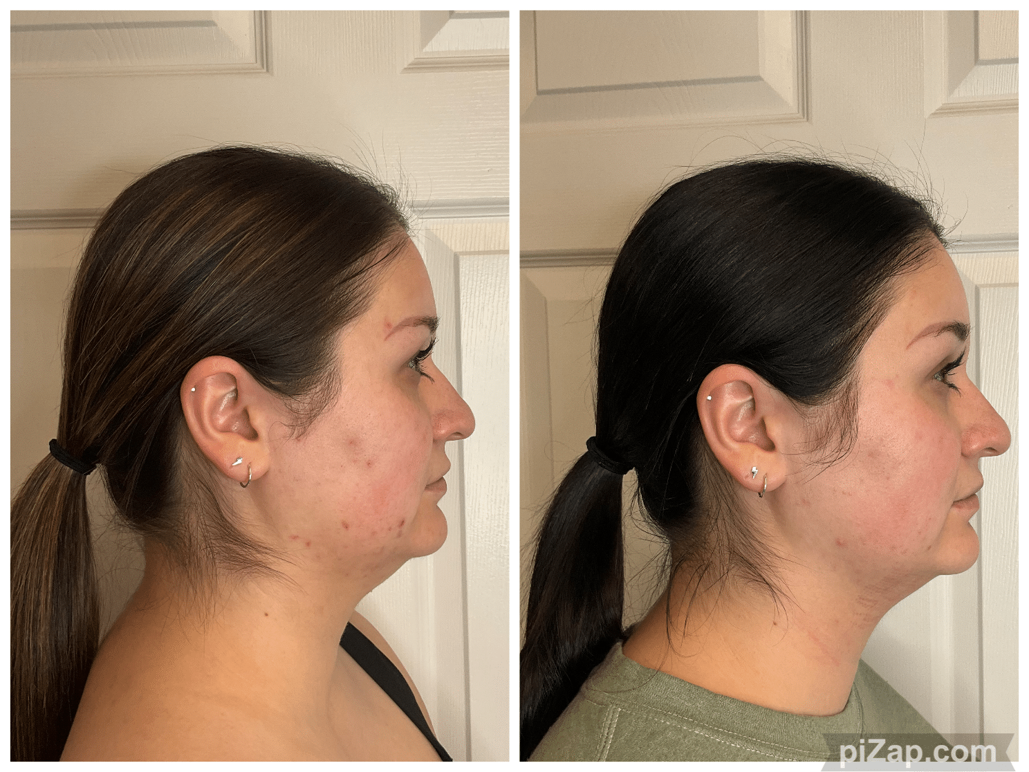 Before and After Image: 3DMiracl - right-side