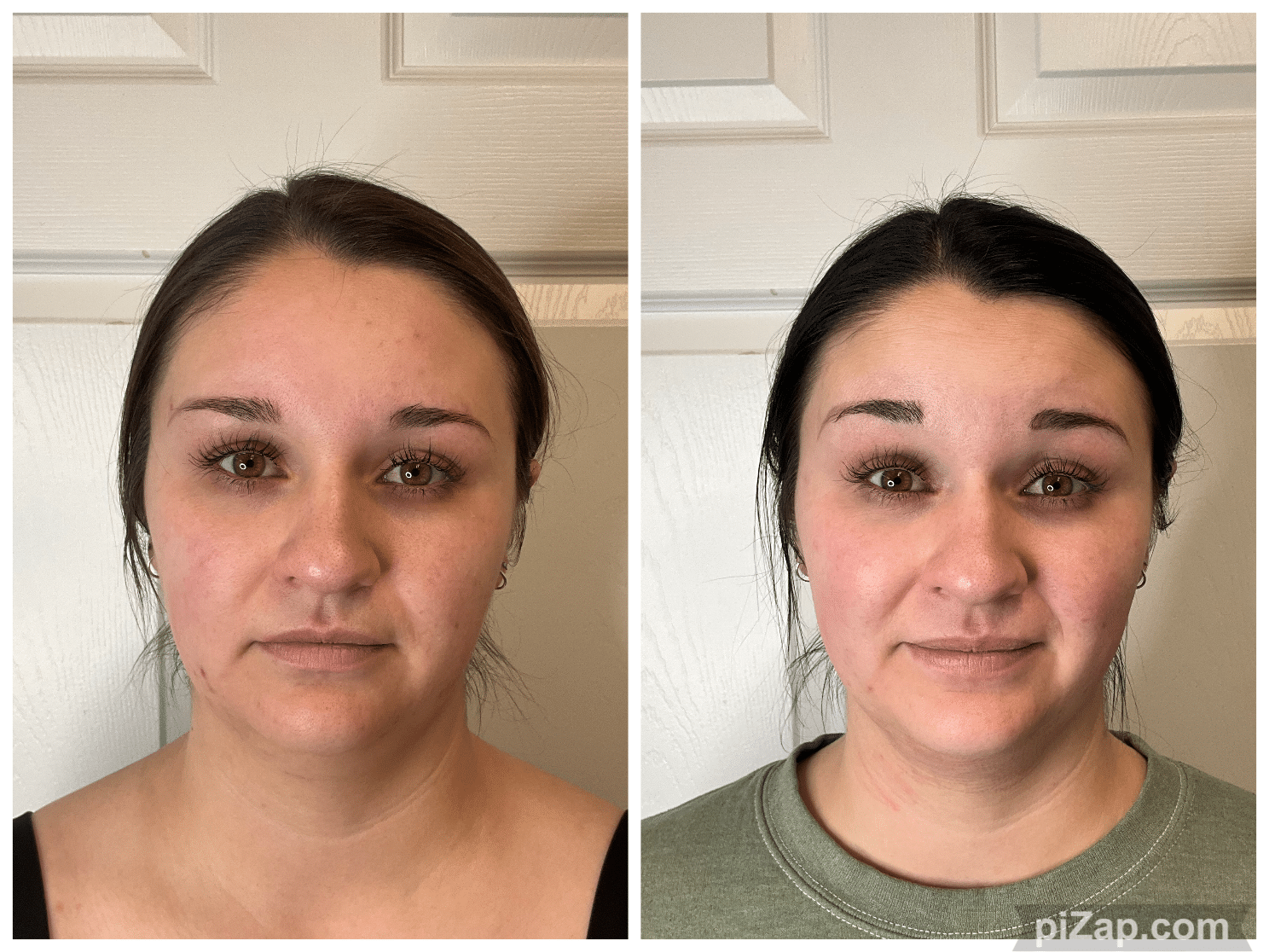 Before and After Image: 3DMiracl - front