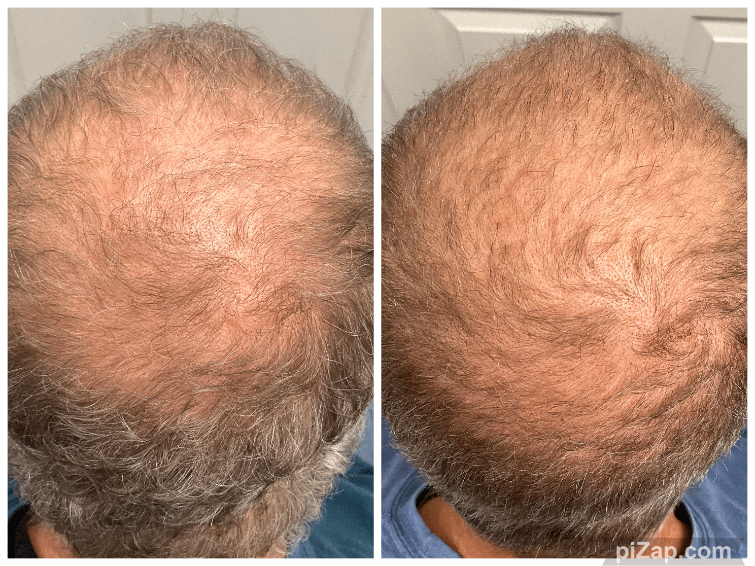 Before and After Image: TED - back