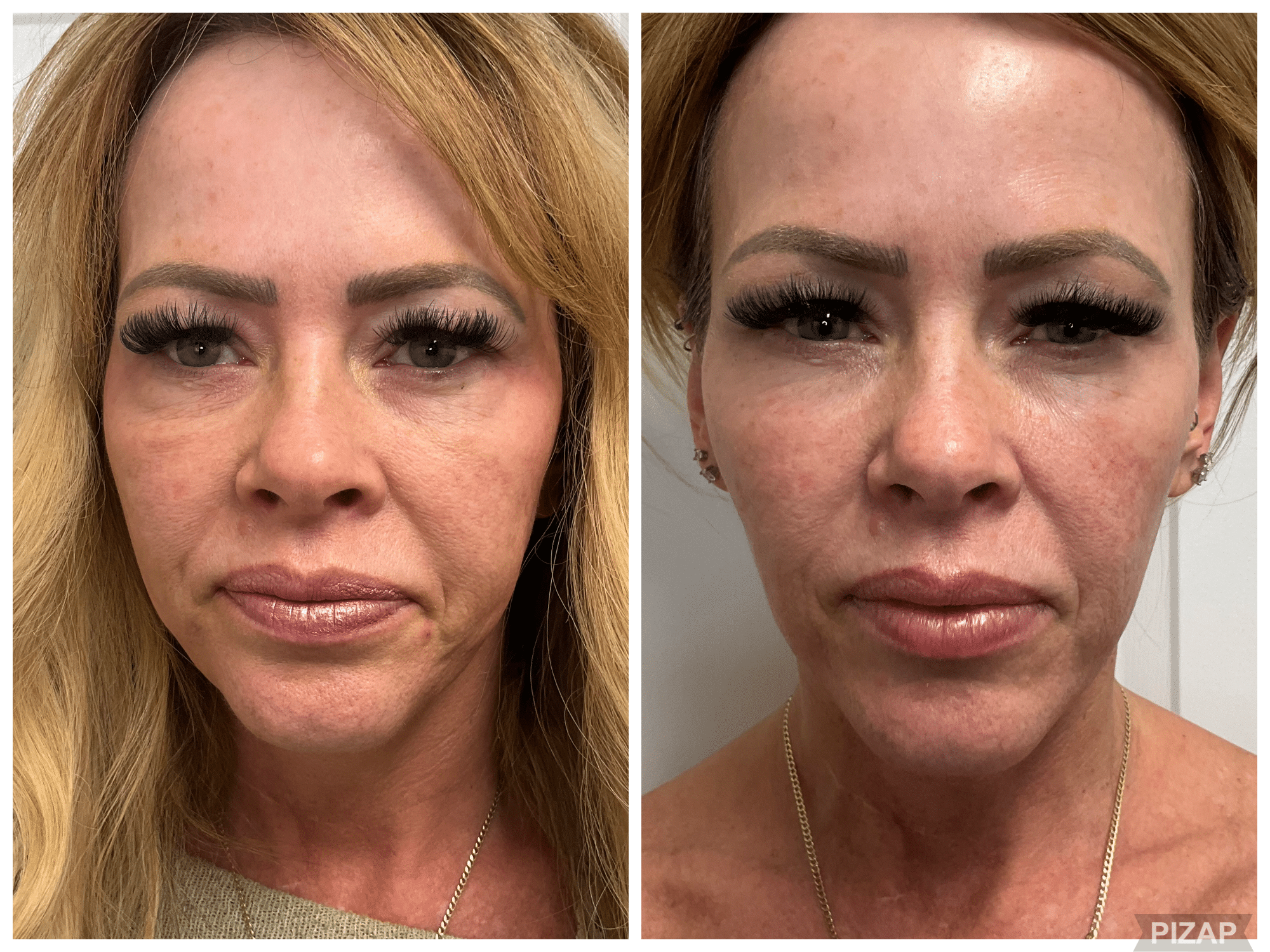 Before and After Image: 3DMiracl - front