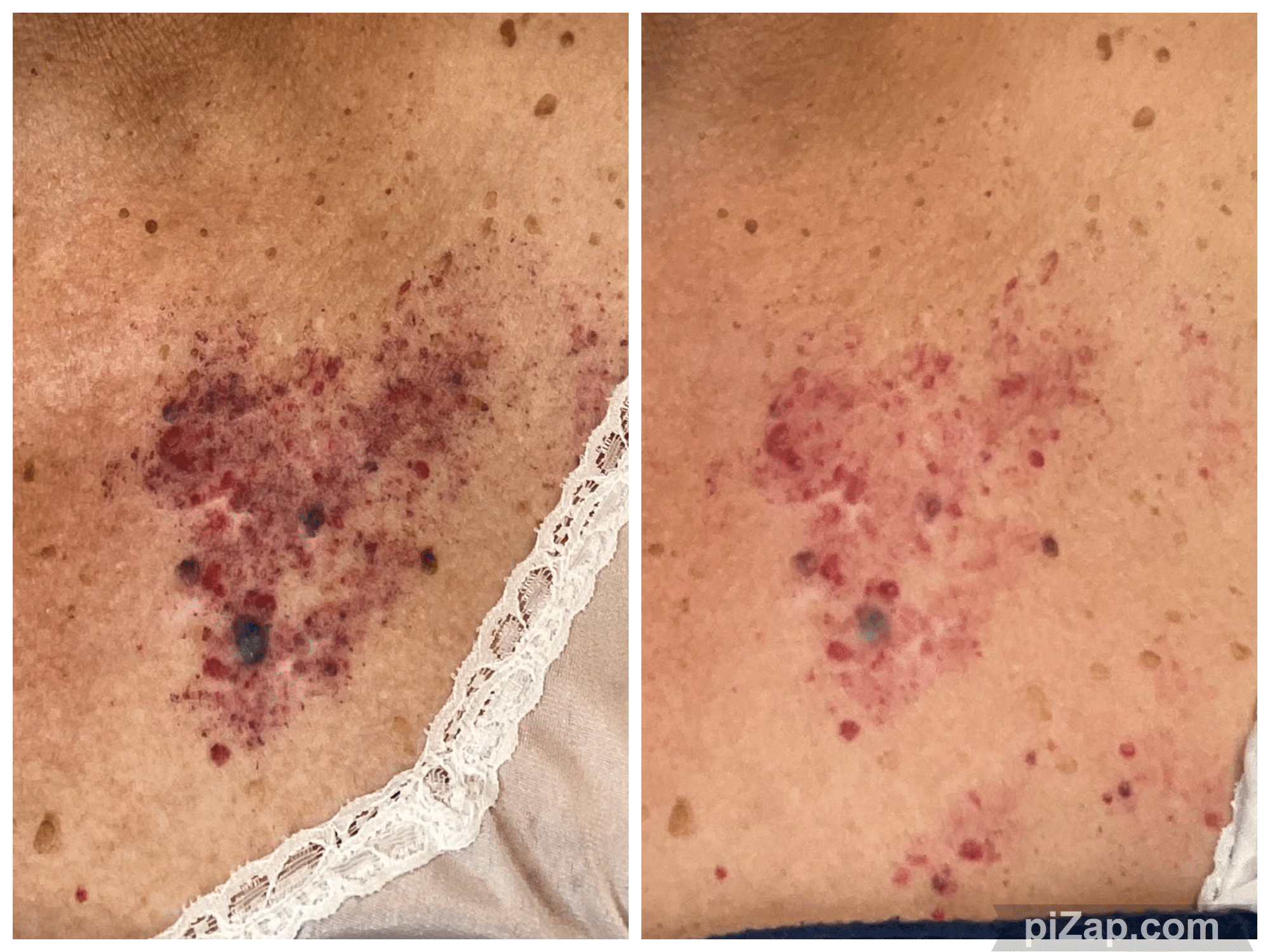 Before and After Image: Lumecca - front